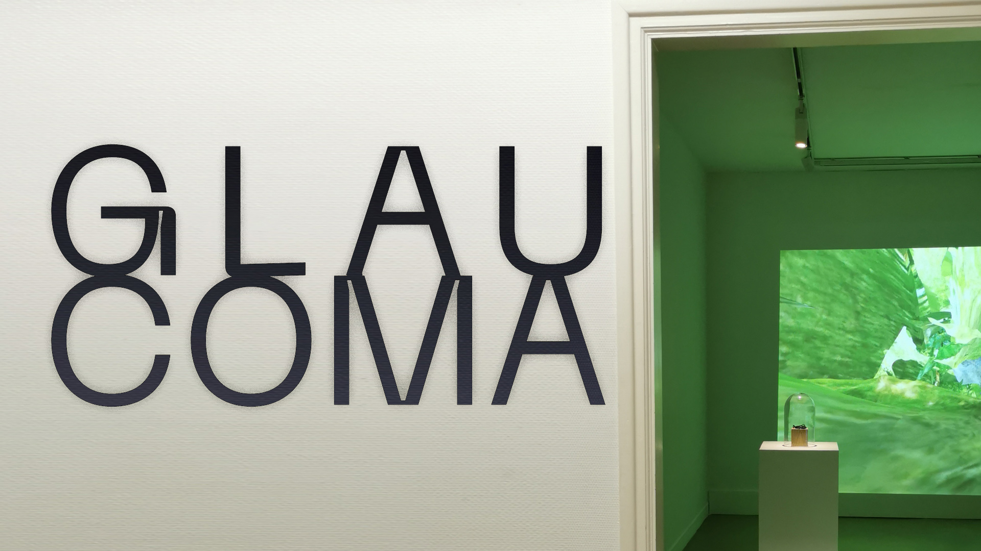 EXPOSITION GLAUCOMA